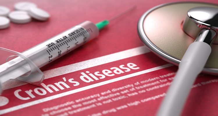 Is Crohn’s Disease a Disability Under SSA